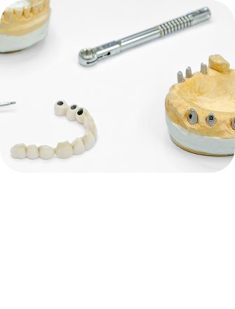 임플란트 시술순서 이미지3