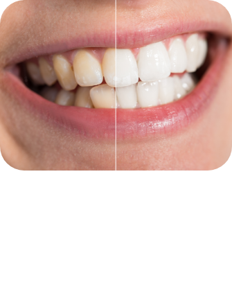 임플란트 시술순서 이미지1