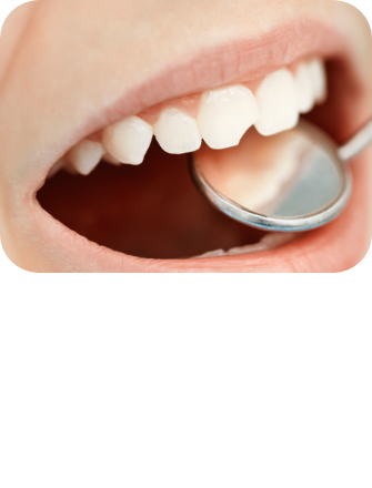 임플란트 시술순서 이미지3