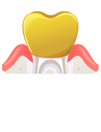 신경치료 시술순서 이미지4