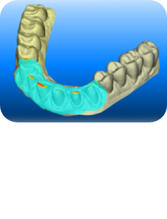 사랑니발치 순서 이미지2